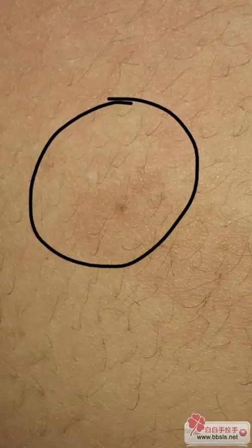 请问我肚皮上的白点是白癜风吗