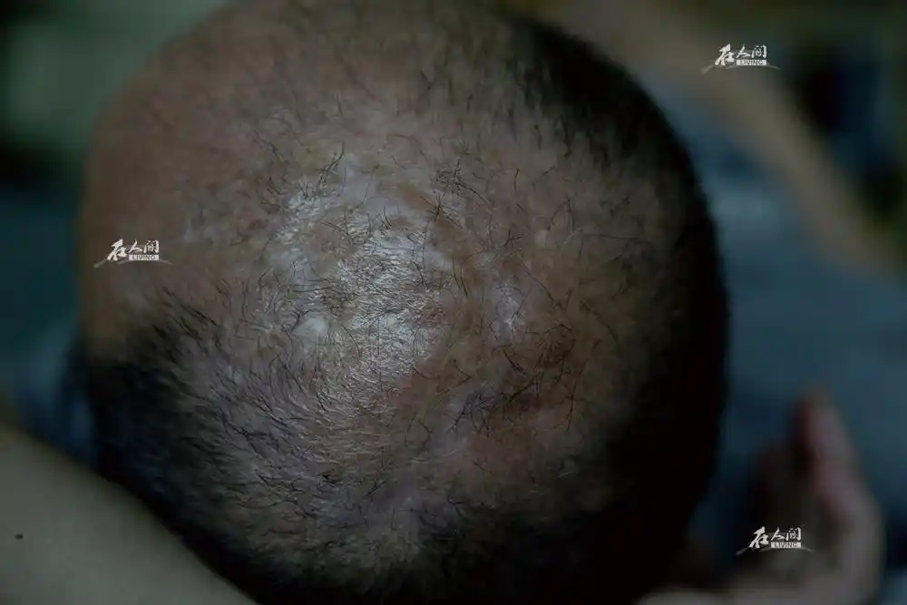 《在人间》第126期:被u型锁砸碎的两个家