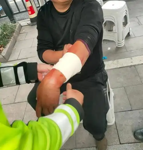 绍兴一男子酒后"自残"遇上交警,交警变身"话痨"一小时|包扎|岗亭|纱布