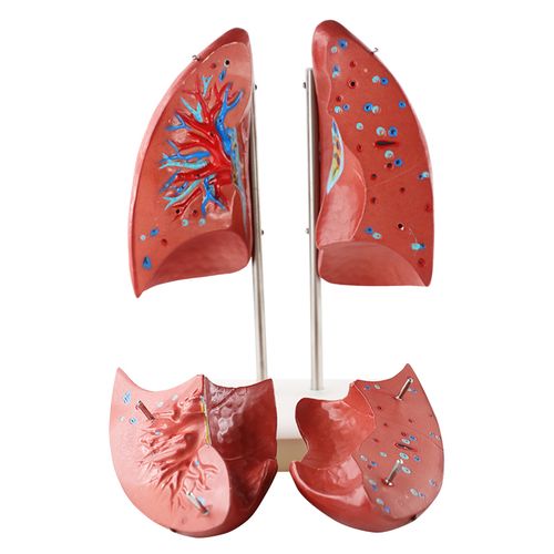 肺模型人体肺解剖模型肺部支气管呼吸结构造教学医学教具模型 肺解剖