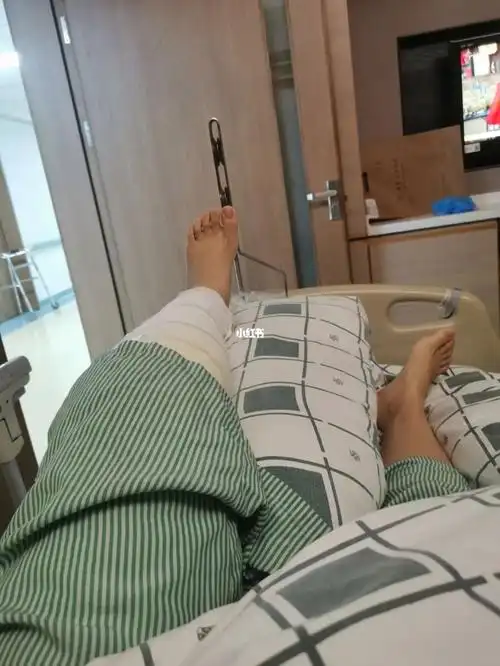 左腿胫骨平台骨折第四天