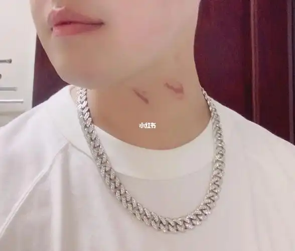 秋天的第一颗草莓91_草莓_秋天去哪玩_中秋节去哪玩_你脖子上的红斑