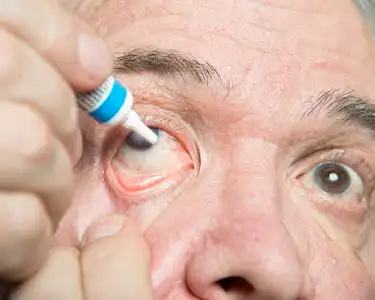 眼科疾病的诊治照片