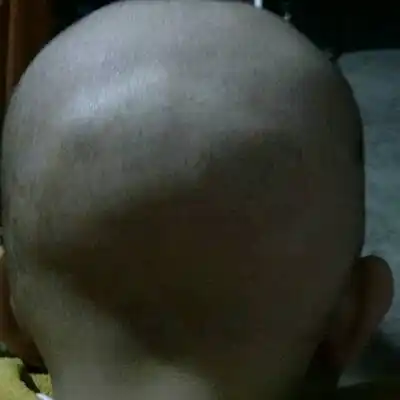 各位宝妈,请帮我看看,宝宝有四个多月,后脑勺突出,有没有什麼事,好