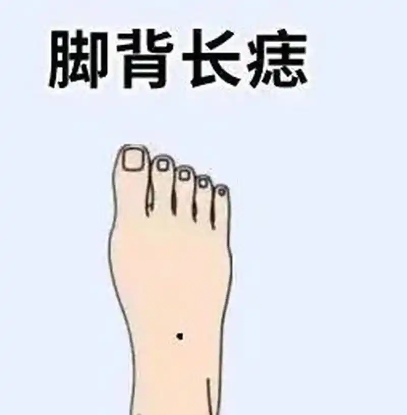 脚背有痣 脚背上长痣算是一种凶痣.