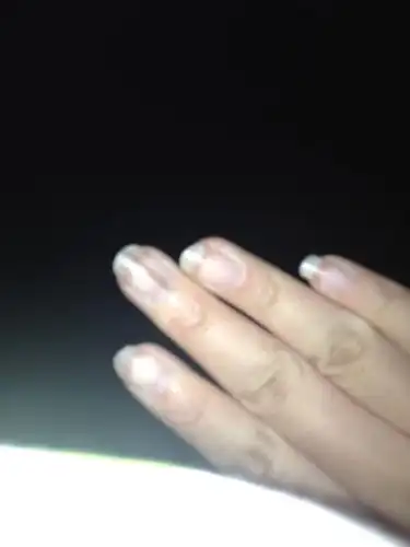 右手中指指甲上有一条黑线.没有受过伤.