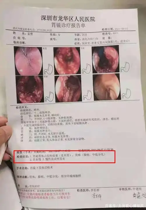 一个女孩撑起一个家!年仅28岁胃癌晚期,救救她,她渴望活下去!