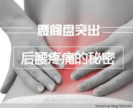 腿脚疼,腿脚麻木等典型症状,但就是后腰痛即腰骶部疼痛,腰骶部疼痛