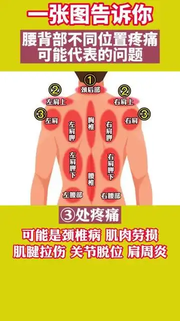 后背不同位置疼痛,可能疼痛问题不一样-度小视