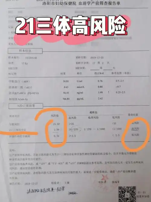 唐筛21三体高风险 羊水穿刺通过7815接好孕