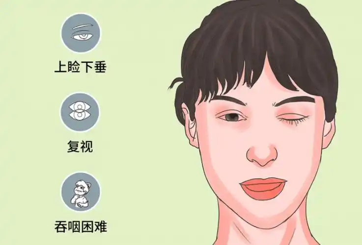 重症肌无力早期症状之全身无力早起的重症肌无力患者从外表看来身体好