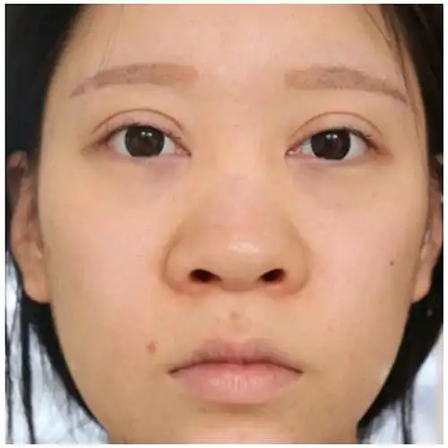 没有鼻梁就算了,竟然还是大鼻头,通箱通我真的五官除了鼻子以外的超美