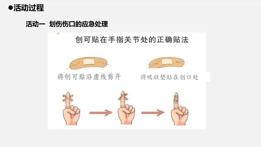 pptx被狗咬伤后的正确处理方法.mp4脚腕扭