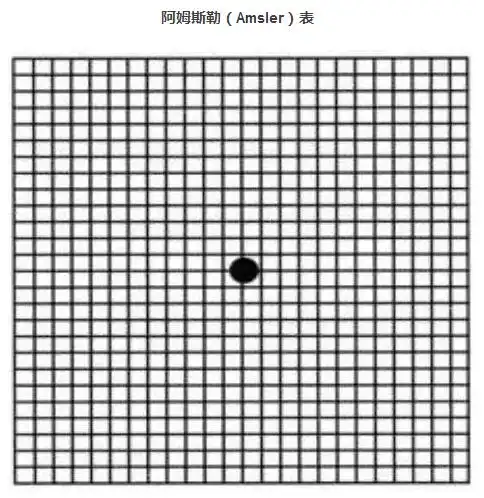 科普健康 眼底病   自测步骤      01把方格表放在视平线30cm的距离