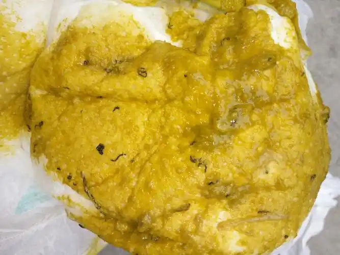 这个是虫吗?宝宝拉出来的