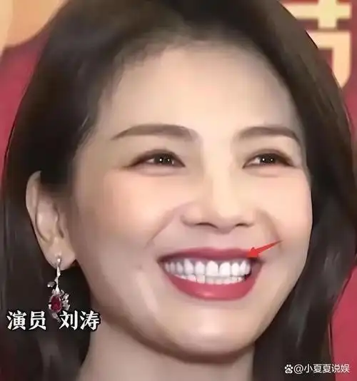 明星烤瓷牙有多可怕嘴凸显老嘴还包不住牙观众直呼辣眼睛