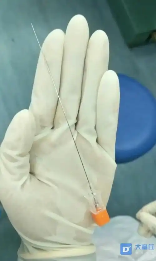 嫂子抛妇产时麻醉用的针头母亲真的是太伟大了