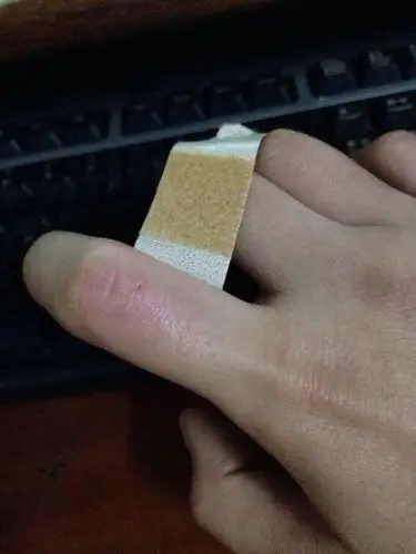 三年前被家养宠物狗咬破手指 昨天被自己养的宠物狗咬破了大拇指 被