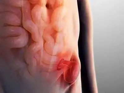 男人疝气症状图片7