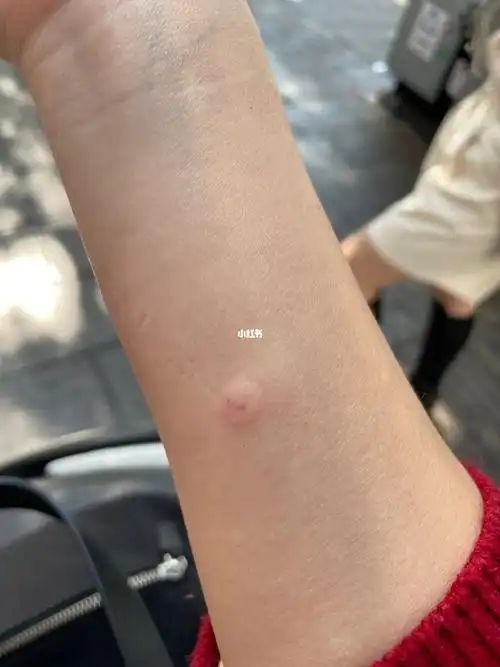 记录下72小时变化,今天第一天