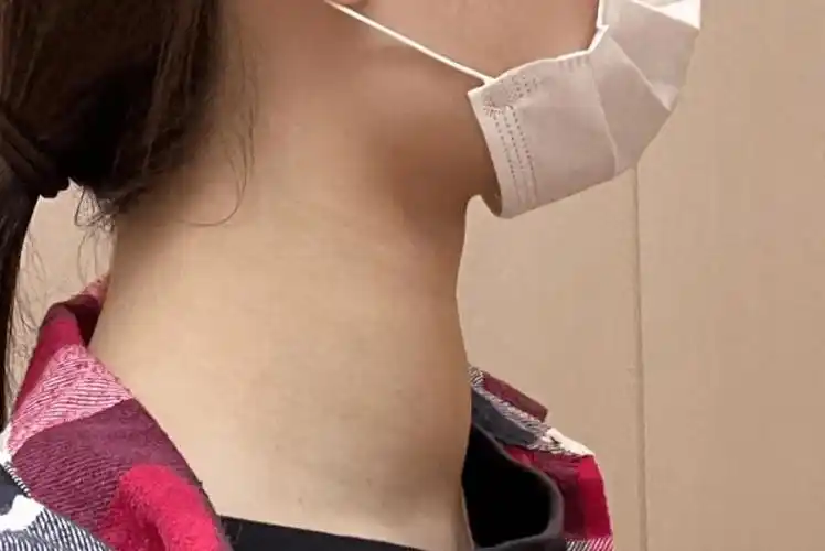 鸡蛋大的肿块居然也能居家消除!_脖子_感觉_方法