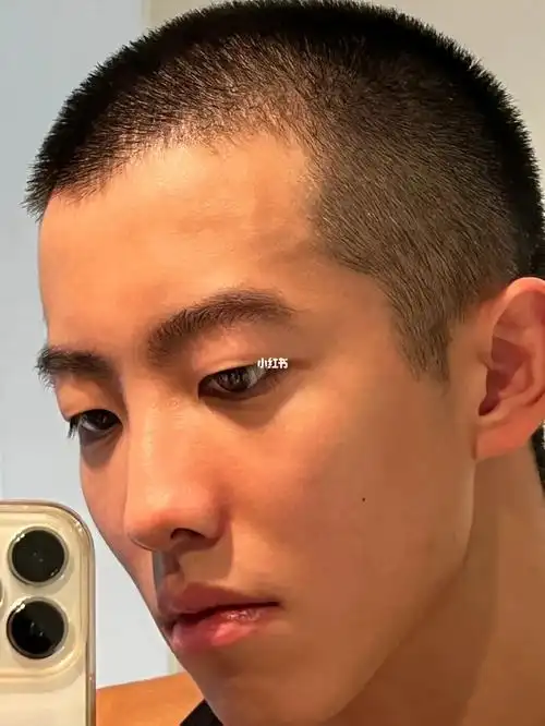 上完厕所额头青筋爆出是什么情况