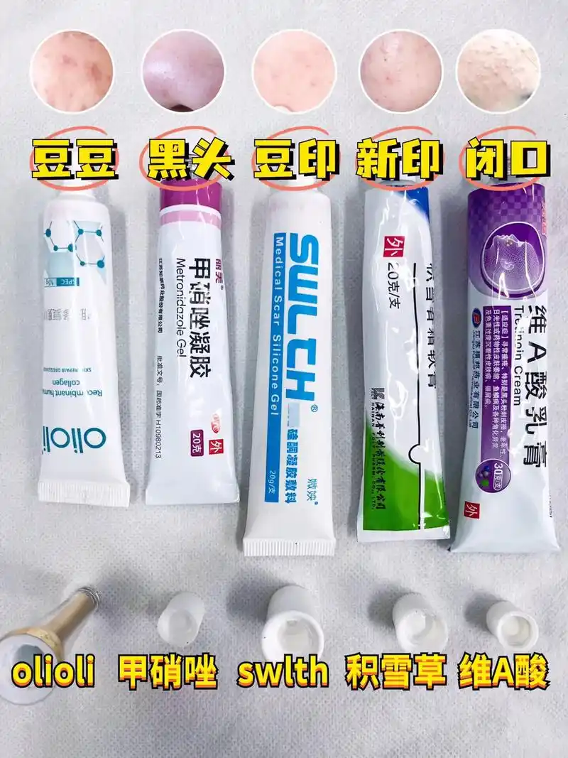 祛痘药膏合集测评!多年使用总结 给大家整理 - 抖音