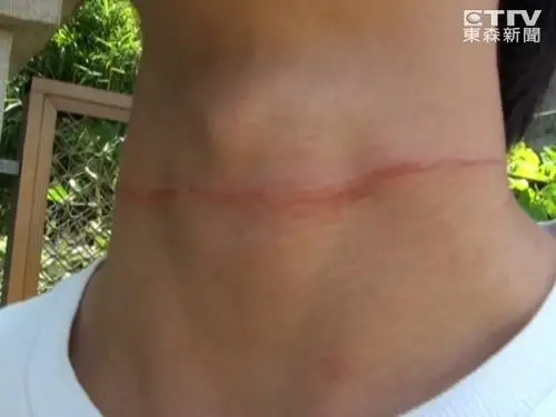 突然看见一条细绳子在眼前,他虽然紧急煞车,还是被绳子缠住脖子,细绳