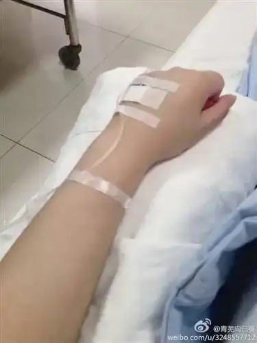 发给我一张照片,照片上有一只手正在打点滴