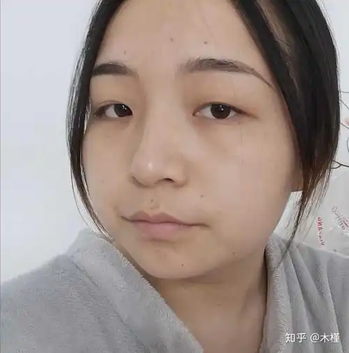 看起来像没得下巴.然后脸超级圆.