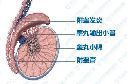 影响性生活,附睾炎是个什么鬼?