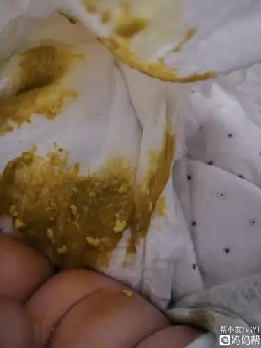 新生儿吃母乳的正常粑粑图片 ( 吃母乳的正常粑粑图片)