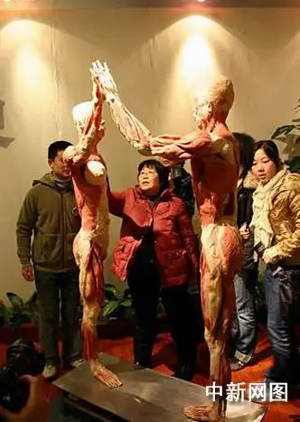 大型人体科普展亮相四川成都(组图)