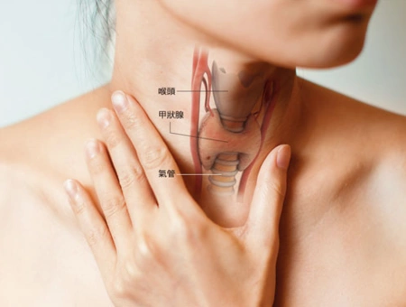 女性甲状腺肿大症状表现有哪些