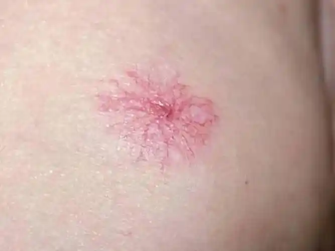 肝病初期身体或会有4个表现医生提醒尽量去拍个肝ct