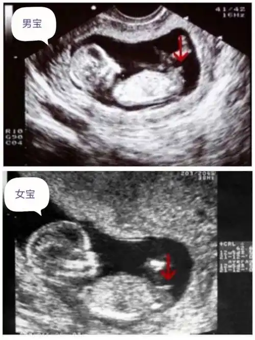 这些nt看男女诀窍建议收藏