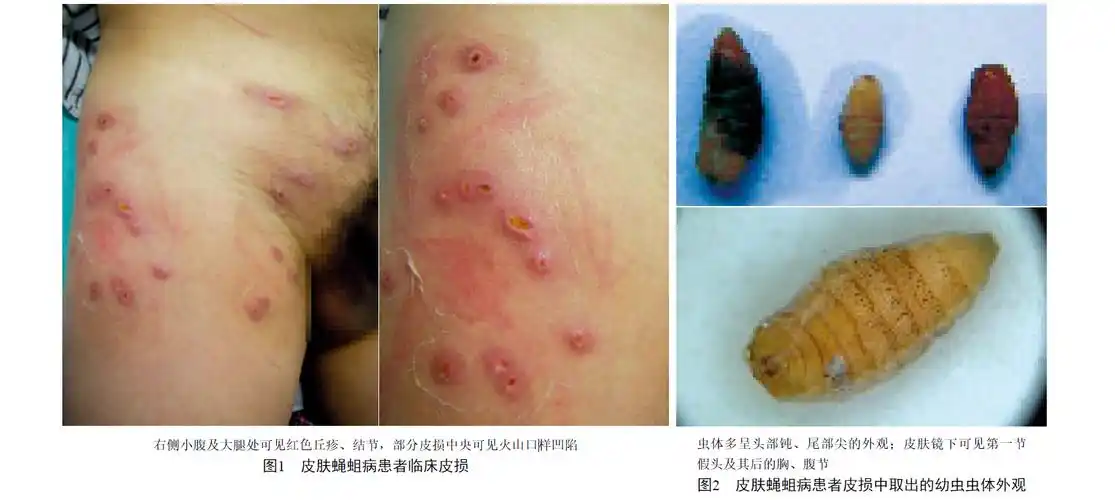 人肤蝇在自然界相对稀有,很难采集. /p>