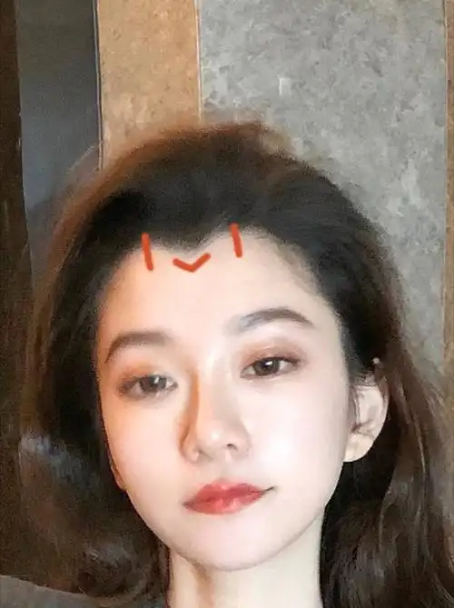 发际线植发审美谈(四)进阶游戏:美人尖什么大小的美_圈子-新氧美容