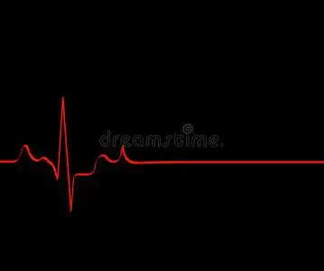 神经细胞死亡图片