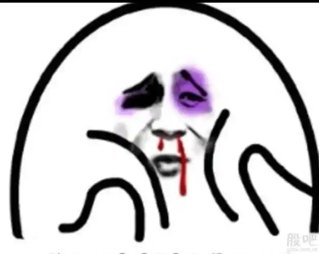 这算不算二边挨揍?真服了我自己