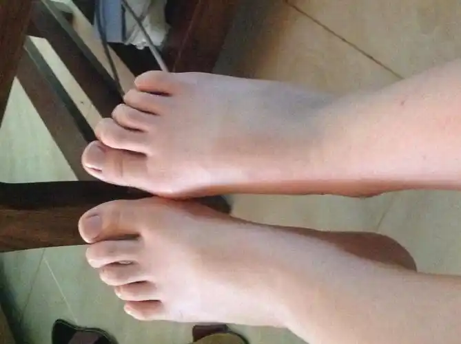 13岁的女生,脚已经有37码了.而且脚又宽又丑,怎么办啊..._百度知道