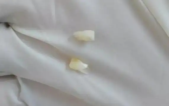 宝宝乳牙关键时能"救命"?但远不止把乳牙保存那么简单