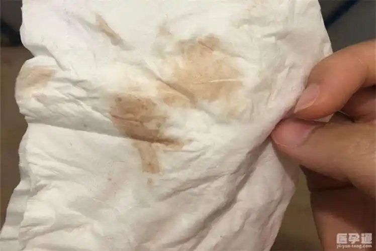 孕早期典型的着床出血真实图片这些细小变化教你学会分辨