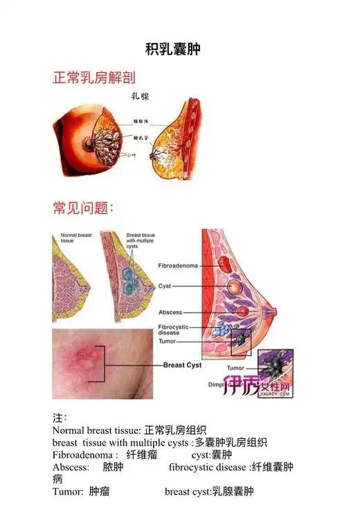 何硕佳带学:常见哺乳期乳房问题触诊形态