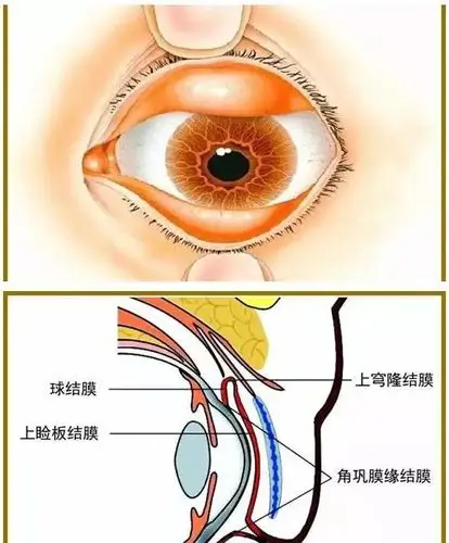 新冠病毒如何经由结膜传播致病的?