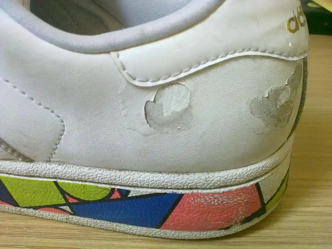 鞋子擦破皮了,怎么补救