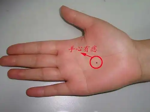 网上晒出手心铅笔"痣",一看评论,原来都是同款"手欠"