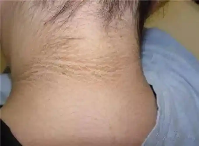 男女这里变黑,你可就要小心了可能是大病前兆为了家人一定要会看