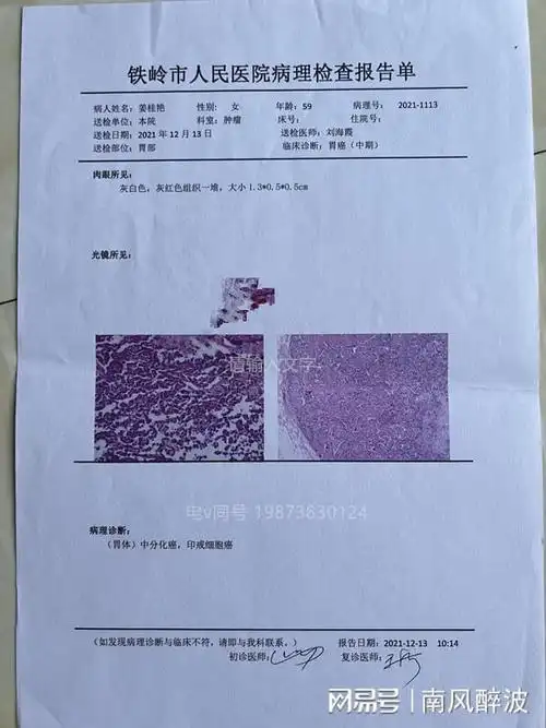 孕期心情不好对胎儿有什么影响卵巢内移到卵巢hgc怀孕血检病历吗
