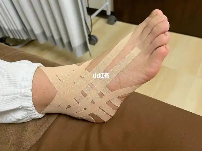 踝关节扭伤消肿运动胶带